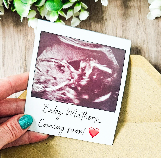 Personalised Baby Scan Magnet, Pregnancy Keepsake, Sonogram Fridge Magnet,