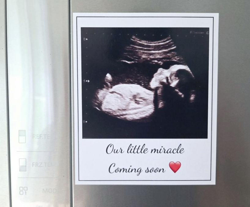 Custom Sonogram Photo Magnet – Personalised Pregnancy Announcement or Ultrasound Keepsake Gift
