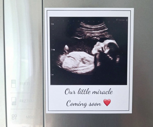 Custom Sonogram Photo Magnet – Personalised Pregnancy Announcement or Ultrasound Keepsake Gift