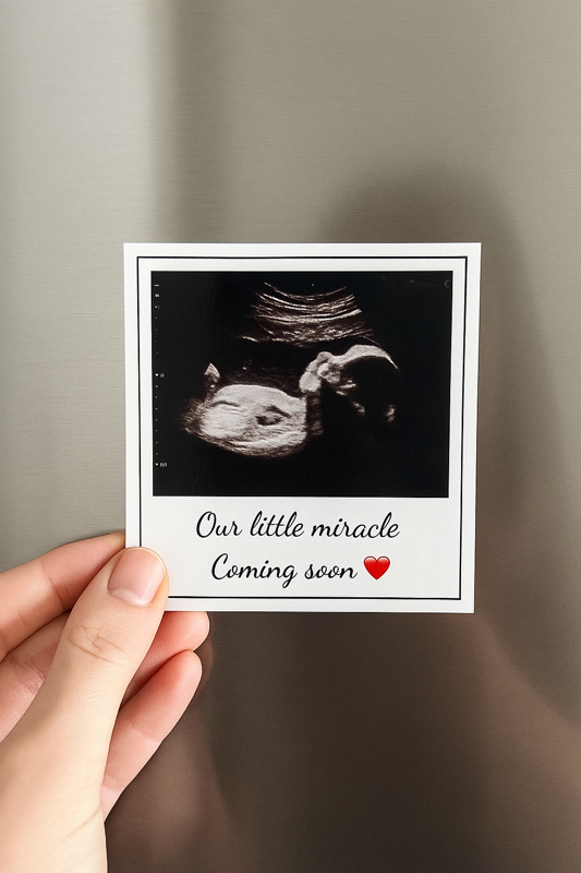 Custom Sonogram Photo Magnet – Personalised Pregnancy Announcement or Ultrasound Keepsake Gift